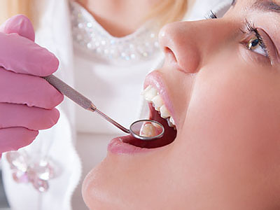 Uyesugi Dental | Dental Sealants, Digital Radiography and Implant Dentistry