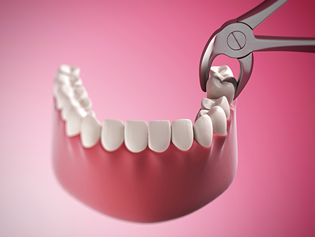 Uyesugi Dental | Pearl AI X-Rays, Dental Bridges and HealthyStart