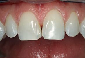 Uyesugi Dental | Dental Fillings, Periodontal Treatment and Ceramic Crowns